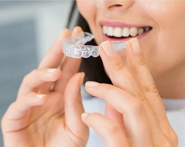 Alinhadores transparentes para tratamento Invisalign