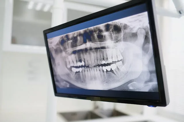Planejamento digital ortodôntico com tecnologia